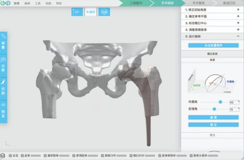 3d打印人体骨骼 这家哈佛大学孵化的公司要为中国医生开发自己的软件平台...